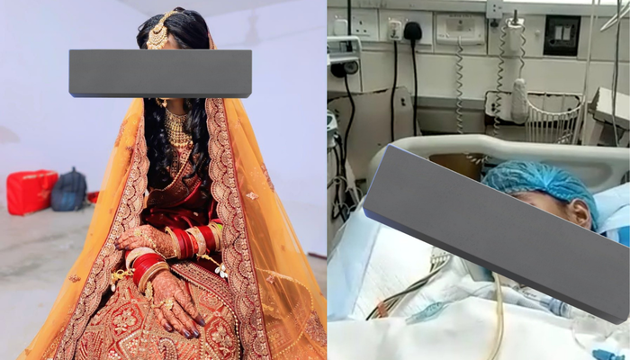 Burnt with hot iron tongs, fed toxins-laced drink: 26-year-old newly-married woman in critical condition after in-laws tortured her for dowry