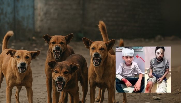 Boy Loses Implant, Suffers Injuries in Nagpur Dog Attack