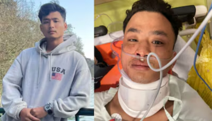 Anjel Chakma was injured in a racist attack in Dehradun.