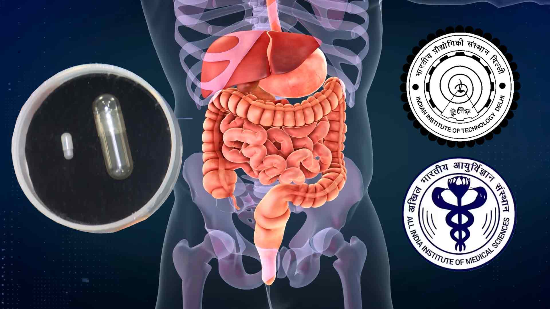 IIT Delhi and AIIMS develop smart capsule for gut microbiome sampling