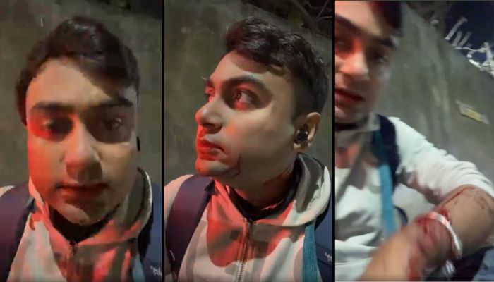 Journalist Attacked in Kolkata for Criticizing Government